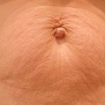 After 4 treatments