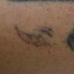 After 3 Treatments